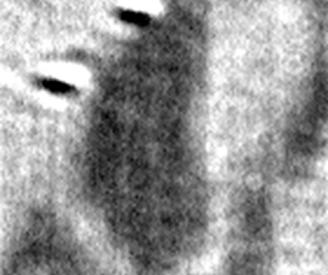 バイラテラルフィルタ無し